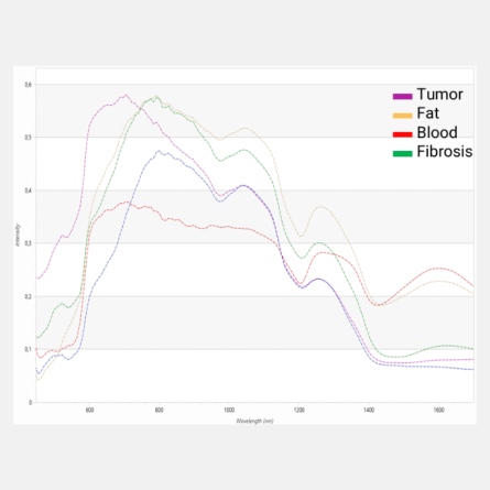 a graph of different coloured spectra featuring tumour, fat, blood and fibrosis